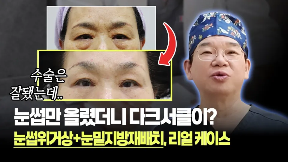 눈썹위거상 1년 이후는 어떻게 변하고 후회 없는 선택을 하려면 무엇을 알아야 할까