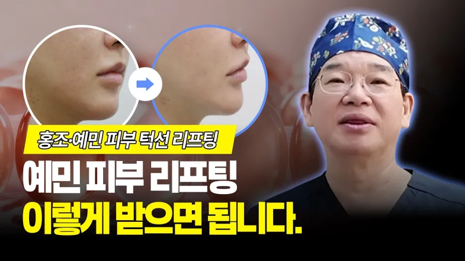 예민피부, 리프팅 시술 가능성과 효과에 대한 정확한 이해